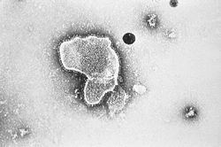 RSウイルスの電子顕微鏡像